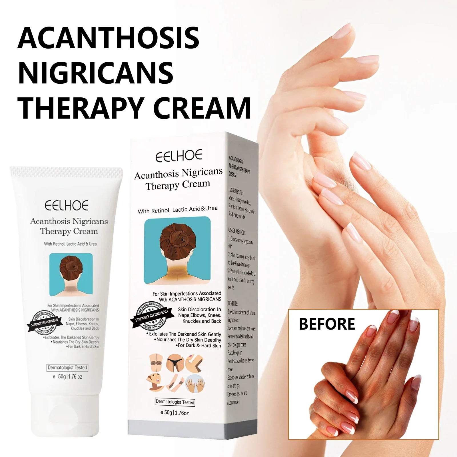 Crema Aclarante - EELHOE